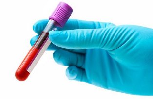exame-de-sangue