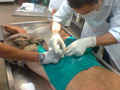 estupradorcirurgia