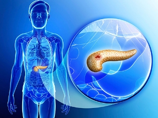 biosenssor