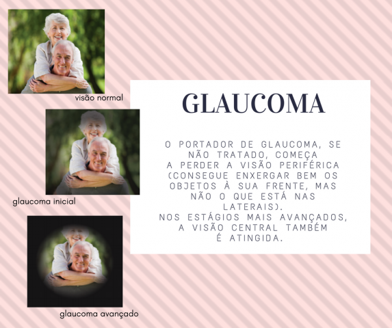 GLAUCOMA f0d8c
