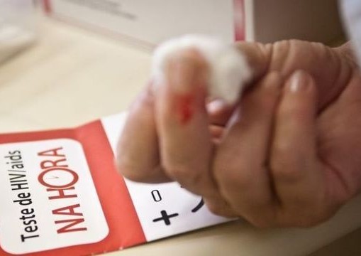 hiv