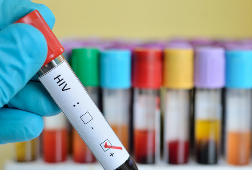 hiv