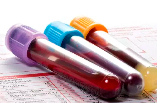 exsangue