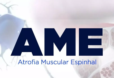ame