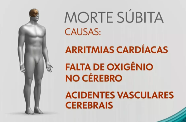 mortsubita