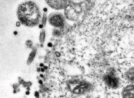virus