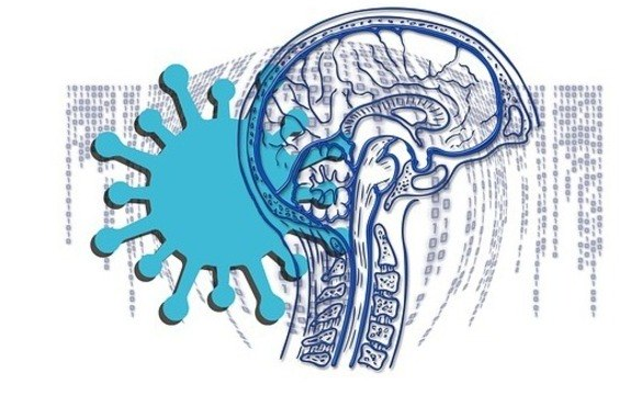cerebro