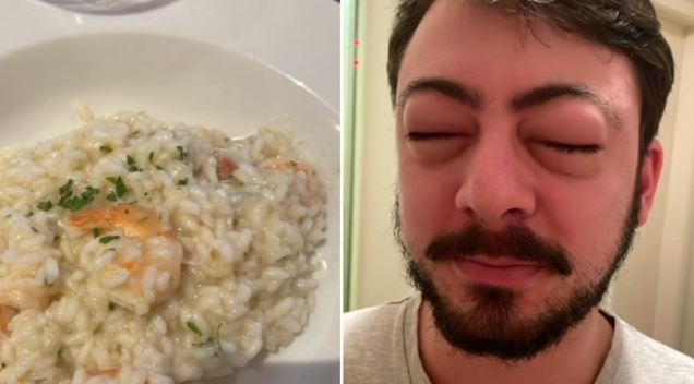 alergia