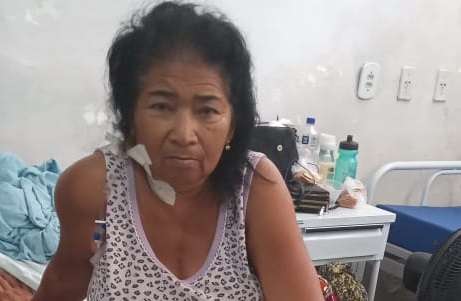 aldeisa