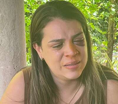 Corretora de imóveis agredida pelo marido diz que tem medo do que ele possa fazer com ela