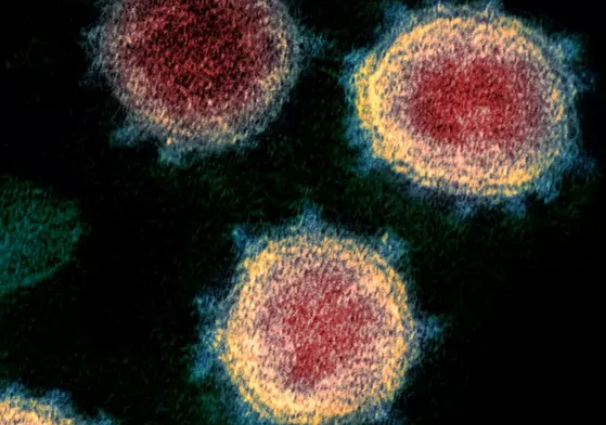 hivcovid
