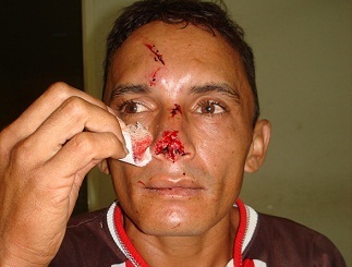 joaoferreira982012