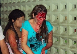 mulheragredida422013