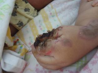 bebeletrocurado222012013