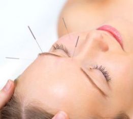acupuntura