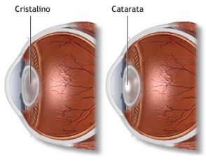 catarata2882012
